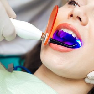 اشعه آبی دندانپزشکی آی ریمید