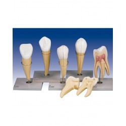 مدل (مولاژ) دندان سری ۵عددی